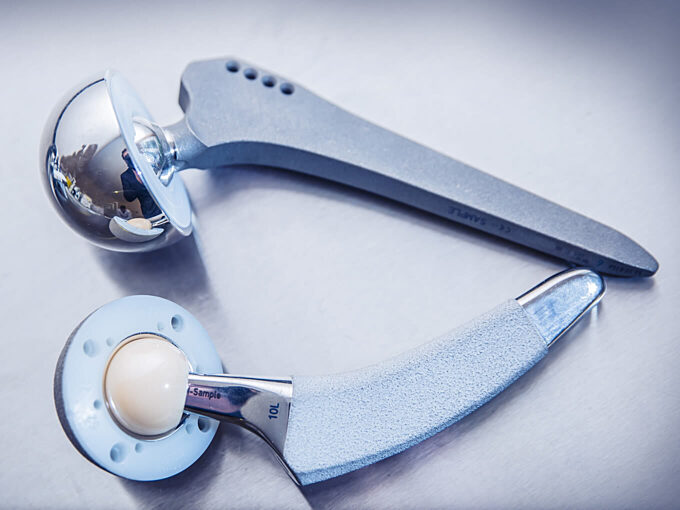 Biocompatibility Testing Bone Cement